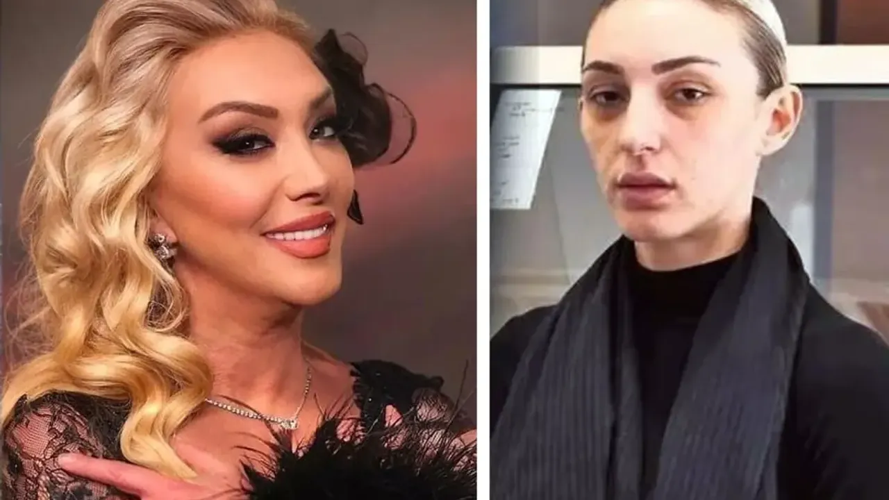 Güllü Son Dakika: Ölüm Nedeni Kesinleşti